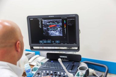 Odessa, Ukrayna - 29 Temmuz 2018: Kadın muayene damarların ultrason sensör modern teknoloji Kliniği üzerinde uğrar. Damarlar ve doppler incelenmesi monitör durumu