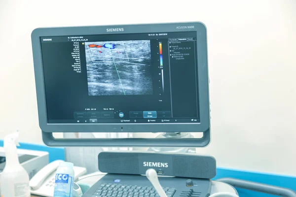 Odessa Ukraine July 2018 Woman Undergoes Medical Examination Veins Ultrasound — Stock Photo, Image