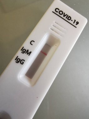COVID-19 için hızlı test cihazı kullanılması sonucu negatif çıktı. Yeni Coronavirus 2019 Çin 'in Wuhan şehrinde bulundu..