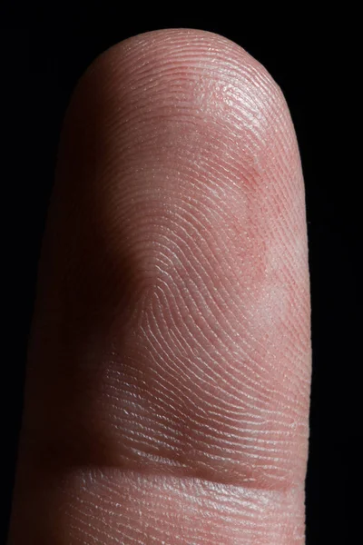 Image Human Finger Close — Stock Photo, Image