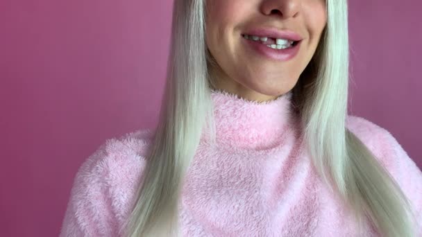Una Donna Con Dente Anteriore Rotto Rimuove Indossa Una Microprotesi — Video Stock