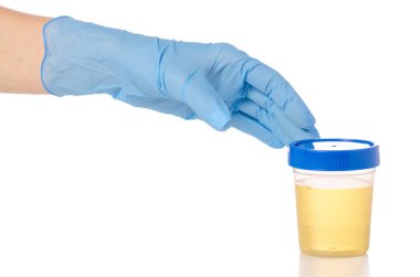 Plastic container with urine in hand analysis clipart