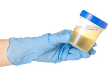Plastik Konteyner ile idrar el Analizi