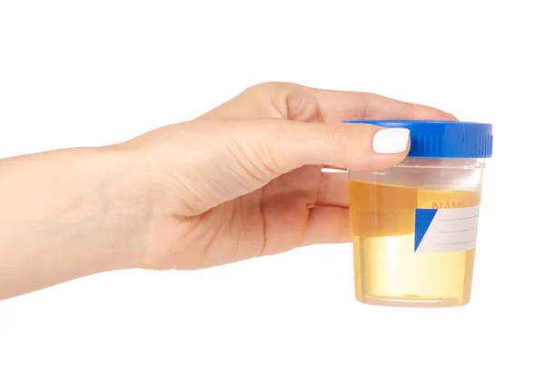 Kunststof container met urine in hand analyse — Stockfoto