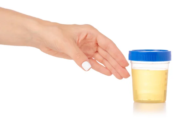 Conteneur en plastique avec analyse d'urine à la main — Photo