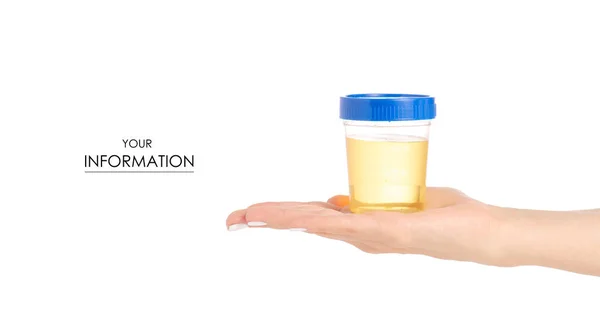 Recipiente de plástico com urina em padrão de análise manual — Fotografia de Stock