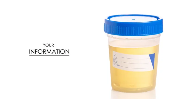 Plastbehållare med urin analys mönster — Stockfoto