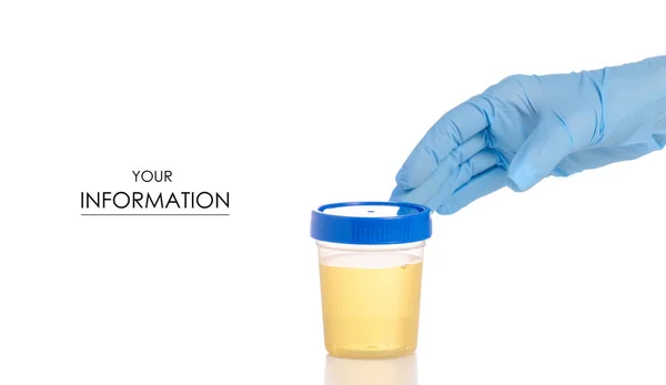 Récipient en plastique avec analyse d'urine à la main — Photo