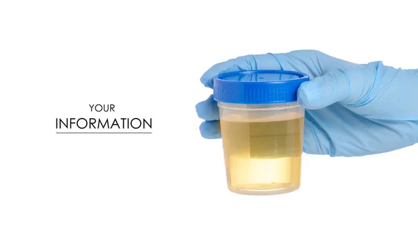 Plastic container with urine in hand analysis pattern — Stock Photo, Image