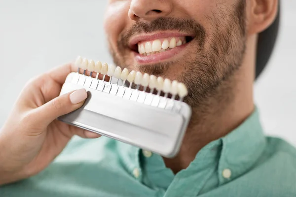 Dentista escolhendo a cor do dente para o paciente na clínica — Fotografia de Stock