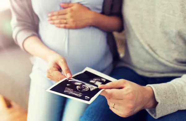 Close up de casal com imagens de ultra-som do bebê — Fotografia de Stock