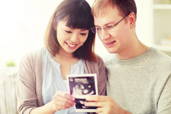 Nahaufnahme eines glücklichen Paares mit Baby-Ultraschall — Stockfoto