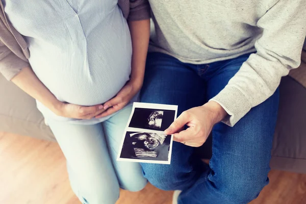 Primer plano de pareja con imágenes de ultrasonido de bebé — Foto de Stock
