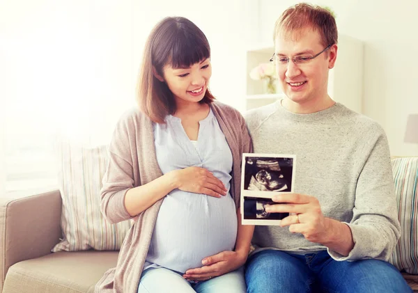 Gelukkige paar met echografie beelden thuis — Stockfoto