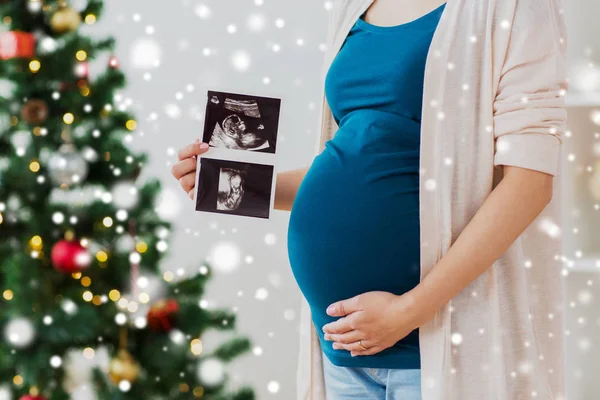 クリスマスに超音波画像妊娠中の女性 — ストック写真