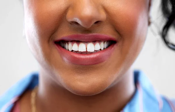 Közelről afro-amerikai nő, fehér fogak — Stock Fotó