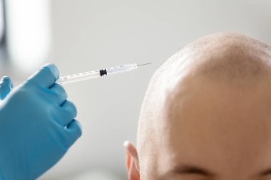 close up of hands with syringe and bald male head clipart