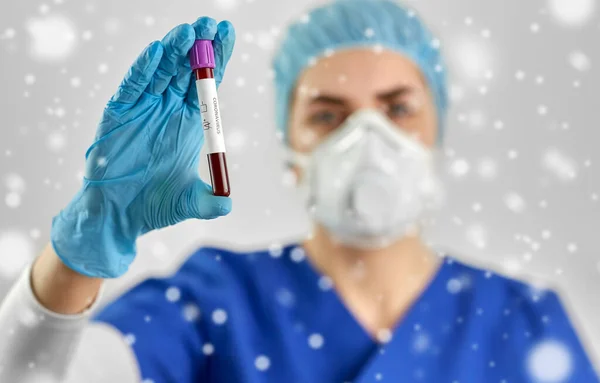 Médico segurando copo com coronavírus teste de sangue — Fotografia de Stock