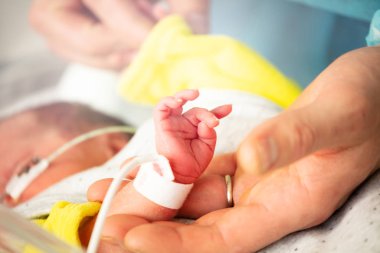 Yoğun bakım odasında anne eli ve prematüre doğan bebek çocuk monitörü ile