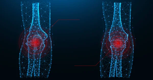 Dirsek eklem ağrısı mavi çokgen vektör çizimi.