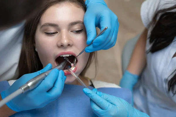 Zbliżenie Otwartej Kobiecej Buzi Lekarz Dentysta Nakłada Plombę Klientkę Pielęgniarka — Zdjęcie stockowe