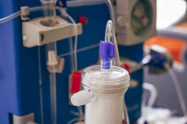 Modern bir diyaliz merkezinde hemodiyaliz makinesi.