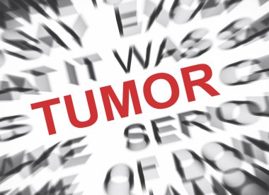 Mevsimlik metin tümör odaklı