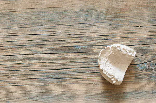 木製テーブルの上の実験室で歯科の大臼歯の石膏模型石膏 — ストック写真