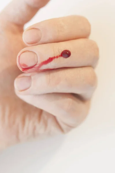 Primo piano del dito mano umana viene tagliato sanguinamento ferito con brillante re — Foto Stock