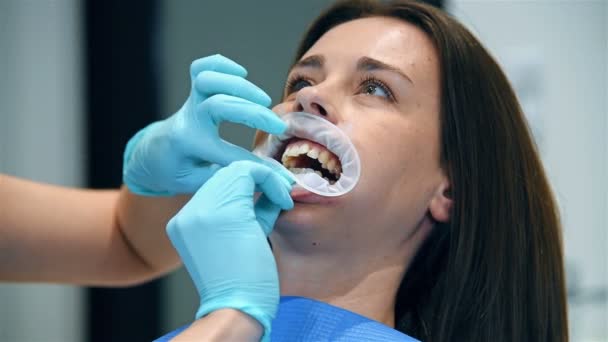 Dentista Põe Anel Oral Boca Paciente Efeito Movimento Lento — Vídeo de Stock