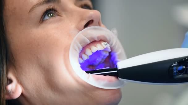 Dentista Corrige Aparelhos Com Uma Lâmpada Infravermelha Fechar — Vídeo de Stock