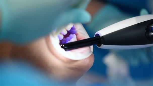 Dentista Assistente Corrige Aparelhos Com Uma Lâmpada Fotopolímero Fechar — Vídeo de Stock