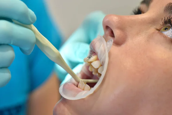 Dentiste examine les dents — Photo