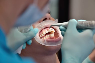 Braket yükleme yordamı