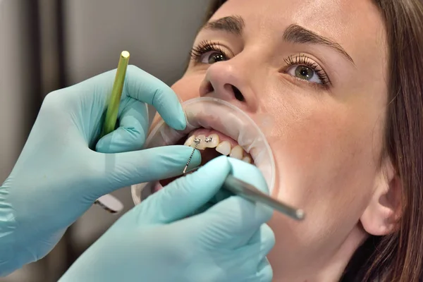 Dentista examina dientes con aparatos ortopédicos —  Fotos de Stock