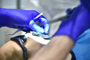 Açık ağız hastayla