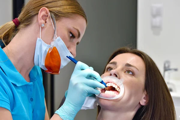 Fijación de aparatos ortopédicos en los dientes —  Fotos de Stock