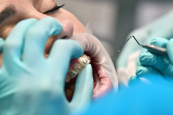 Preparando Para Instalar Aparelhos Nos Dentes Tratamento Dental Conceito Médico — Fotografia de Stock