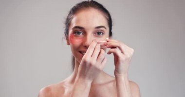 Gözlerinin altındaki kollajen yastıkları kadınla