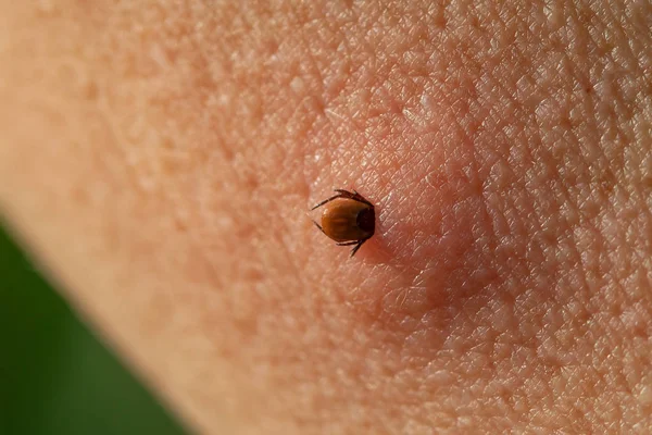 Castor bean tick (Ixodes ricinus) — Stock Photo, Image