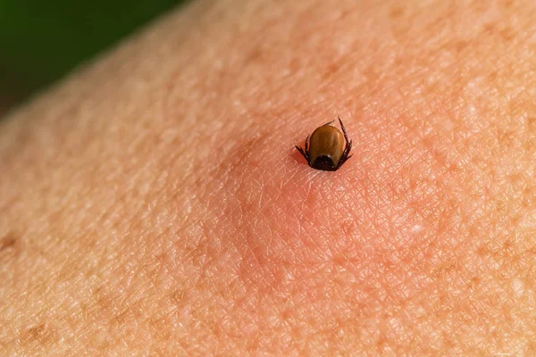 Castor bean tick (Ixodes ricinus) — Stock Photo, Image