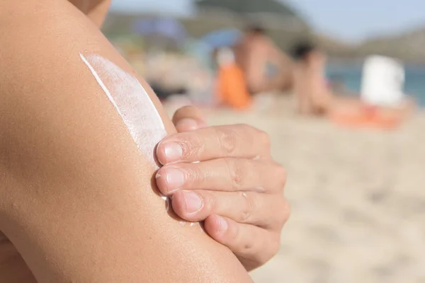 Closeup Young Caucasian Man Beach Applying Sunscreen His Arm — Stock Photo, Image