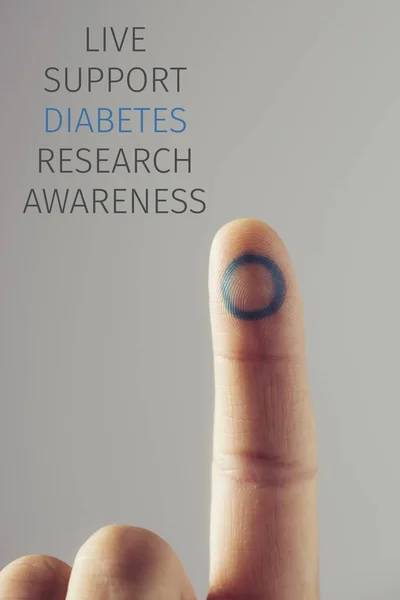 Forefinger Young Caucasian Man Blue Circle Symbol Diabetes Words Related — Stock Photo, Image