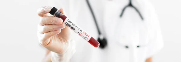 Légzőmaszkot Viselő Nővér Pozitív Vérvizsgálati Eredménnyel Gyorsan Terjedő Coronavirus — Stock Fotó