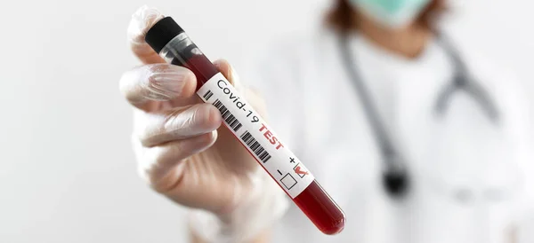 Coronavirus Pozitív Vérvizsgálati Eredményét Mutató Nővér — Stock Fotó