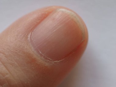 Erkek el parmak ve tırnak ucu