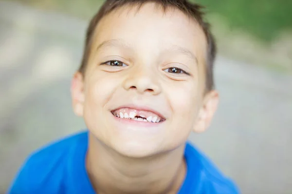 Joven niño sonriendo y mostrando sus dientes de bebé cambiantes —  Fotos de Stock