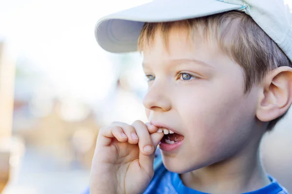 彼の指で彼のぐらつき乳歯を振る少年の閉鎖 前歯の上だ ヘルスケアと歯科衛生の概念 — ストック写真