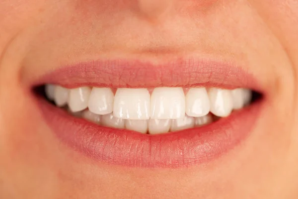 Piękne Kobiety Zdrowe Zęby — Zdjęcie stockowe