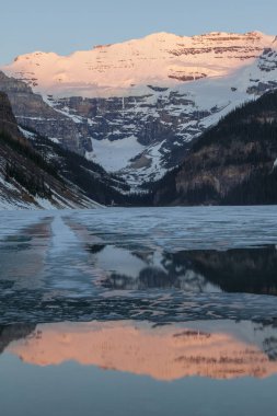 Banff Ulusal Parkı 'nda Louise Gölü